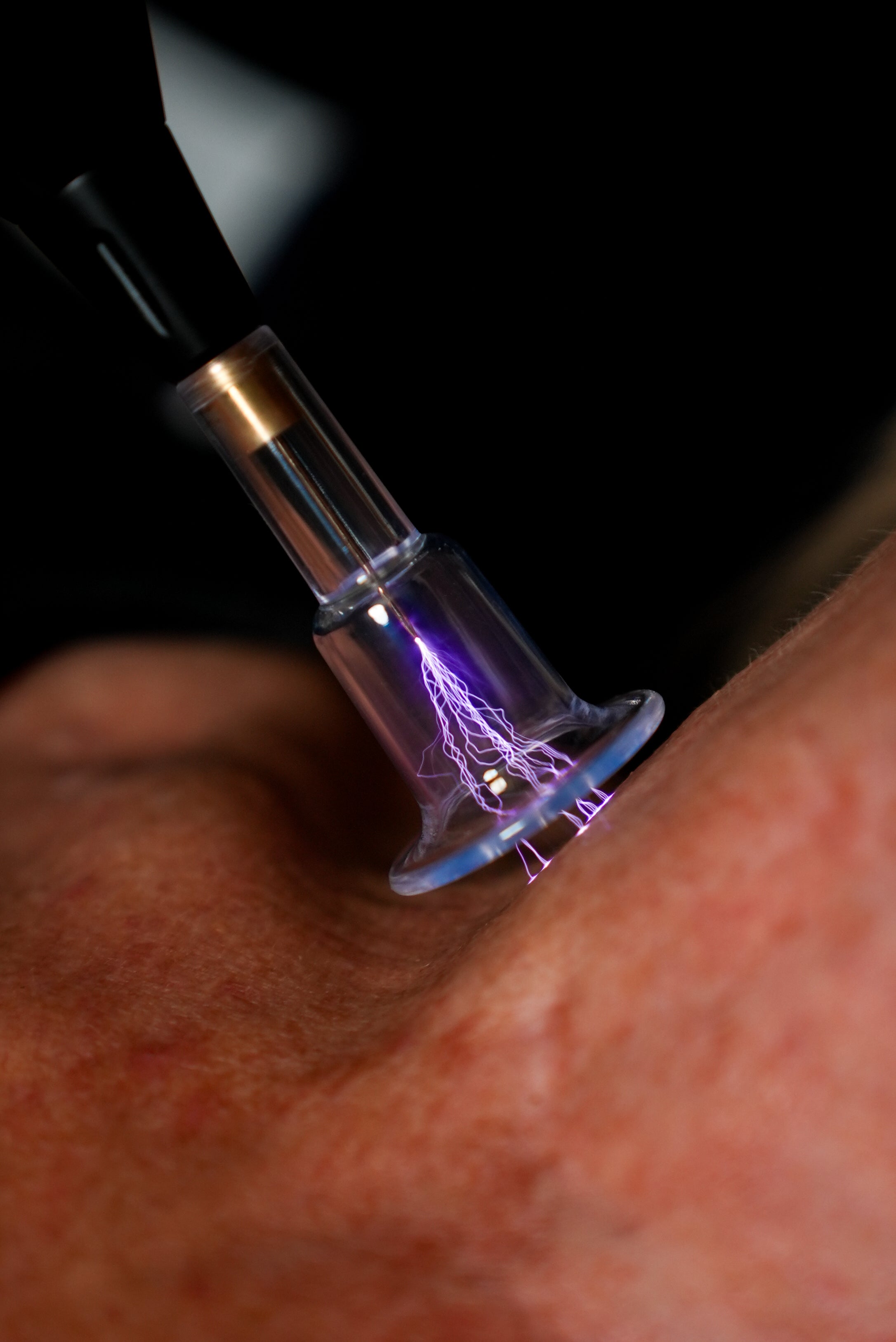 Fusion Complete box Probes